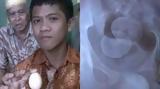 Μοναδικό, 14χρονος, Ινδονησία,monadiko, 14chronos, indonisia