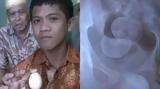 Ανεξήγητο, 14χρονος, Ινδονησία,anexigito, 14chronos, indonisia