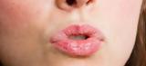 7 τρόποι να απαλλαγείτε από τα σκασμένα χείλη,
