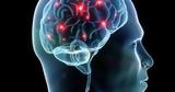 Νέα έρευνα συνδέει τις εγκεφαλικές κακώσεις με τον κίνδυνο εμφάνισης άνοιας,