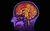 Οι ερευνητές εντόπισαν νέα περιοχή στον εγκέφαλο που επηρεάζει την όρεξη και το σωματικό βάρος,