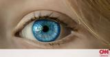 Οι ειδικοί προειδοποιούν όσους φορούν φακούς: Σε έξαρση μόλυνση που προκαλεί τύφλωση,