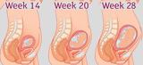 Β τρίμηνο εγκυμοσύνης: Τα στάδια εξέλιξης του μωρού εβδομάδα προς εβδομάδα,