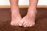 Τι μπορεί να αποκαλύψει το χρώμα των νυχιών στα πόδια μας για την υγεία μας;,