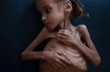 Πέθανε, Υεμένης,pethane, yemenis