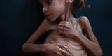 Πέθανε, 7χρονο, Υεμένη,pethane, 7chrono, yemeni