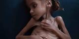 Τραγωδία, Πέθανε, 7χρονη Αμαλ –, -σύμβολο, Υεμένη,tragodia, pethane, 7chroni amal –, -symvolo, yemeni