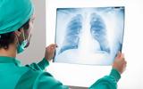 Οι επιστήμονες ανακάλυψαν νέο αναστολέα που μειώνει τη φλεγμονή των πνευμόνων,