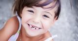 Το απίστευτο τρικ ενός οδοντιάτρου για να σώσεις το σπασμένο δόντι του παιδιού σου -Η απλή διαδικασία,