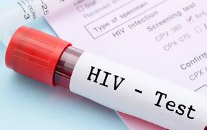 Επιβεβαιώθηκε, HIV, epivevaiothike, HIV
