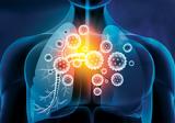 5 αναπνευστικές λοιμώξεις που πρέπει να μας ανησυχούν εκτός του κορωνοϊού,