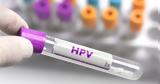 HPV,