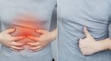 Νόσος, Crohn, Ποια, – Ποια,nosos, Crohn, poia, – poia