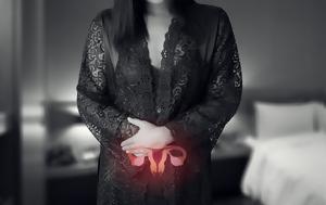 Αδενομύωση, adenomyosi
