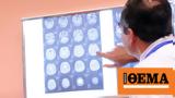 Bombshell, Possible,Alzheimer’s