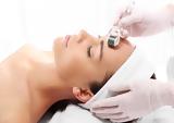 Microneedling,