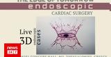 Edge,Tomorrow - Endoscopic Cardiac Surgery