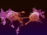 O πρώτος άτλας του μυκητοβιώματος του καρκίνου,
