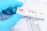 ΦΕΚ, Δημιουργείται Εθνικό Μητρώο, HIV,fek, dimiourgeitai ethniko mitroo, HIV