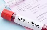 Δημιουργείται Εθνικό Μητρώο, HIV,dimiourgeitai ethniko mitroo, HIV