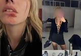 «Θα σας σκοτώσω με τα ίδια μου τα χέρια» – Η καταγγελία του μοντέλου για τον ξυλοδαρμό,το ηχητικό και η απάντηση του DJ