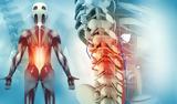 Σπονδυλική, Συμπτώματα,spondyliki, sybtomata