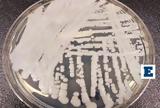 Candida Auris, Άλυτος,Candida Auris, alytos