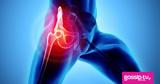 Οστεοαρθρίτιδα,osteoarthritida