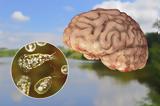 Τι είναι και πως μεταδίδεται η αμοιβάδα που «τρώει» τον εγκέφαλο,