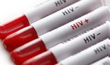 Κως, Άνδρας, HIV,kos, andras, HIV