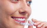 Ισια, ΑΟΡΑΤΗ ΟΡΘΟΔΟΝΤΙΚΗ,isia, aorati orthodontiki