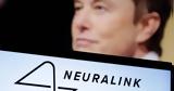 Ελον Μασκ, Επιτυχημένη, Neuralink,elon mask, epitychimeni, Neuralink