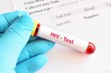 10 Έλληνες, HIVAIDS, - Απογοητευτικά, ECDC,10 ellines, HIVAIDS, - apogoiteftika, ECDC