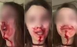 Άμφισσα, Αιμόφυρτη 23χρονη –,amfissa, aimofyrti 23chroni –