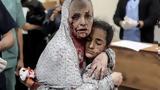 Γάζα, ΟΗΕ, Ισραήλ, 24ωρα,gaza, oie, israil, 24ora