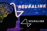 Άλμα, Neuralink-,alma, Neuralink-