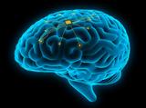 Neuralink, Εμφύτευσαν, Έλον Μασκ,Neuralink, emfytefsan, elon mask