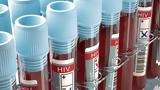 HIV, Ερευνητές, – Συνεχώς,HIV, erevnites, – synechos