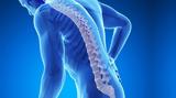 Οστεοπόρωση -,osteoporosi -