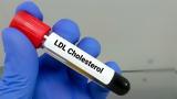 Χαμηλά, LDL, Αλτσχάιμερ,chamila, LDL, altschaimer