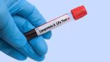 Λιποπρωτεΐνη, Lpa,lipoproteΐni, Lpa