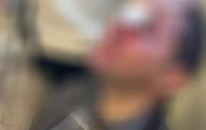 Επίθεση, Νομική Αθηνών, Μία, – Δολοφονική, epithesi, nomiki athinon, mia, – dolofoniki