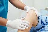 Αρθροπλαστική,arthroplastiki